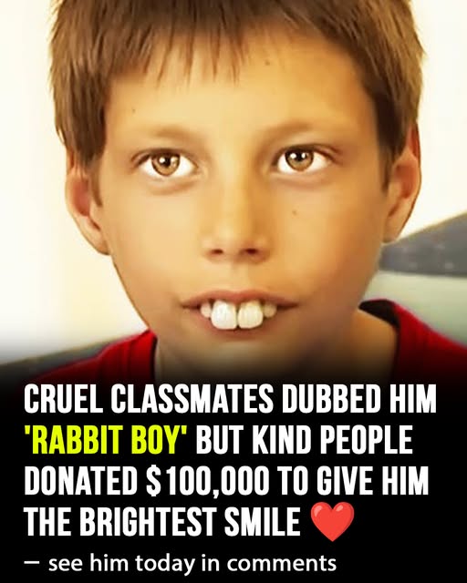 His classmates called him “rabbit boy”