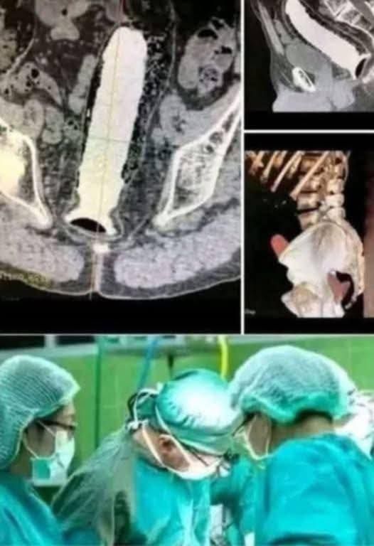 Girl was hospitalized