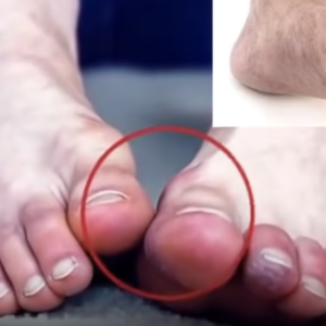 Here are five unusual foot symptoms
