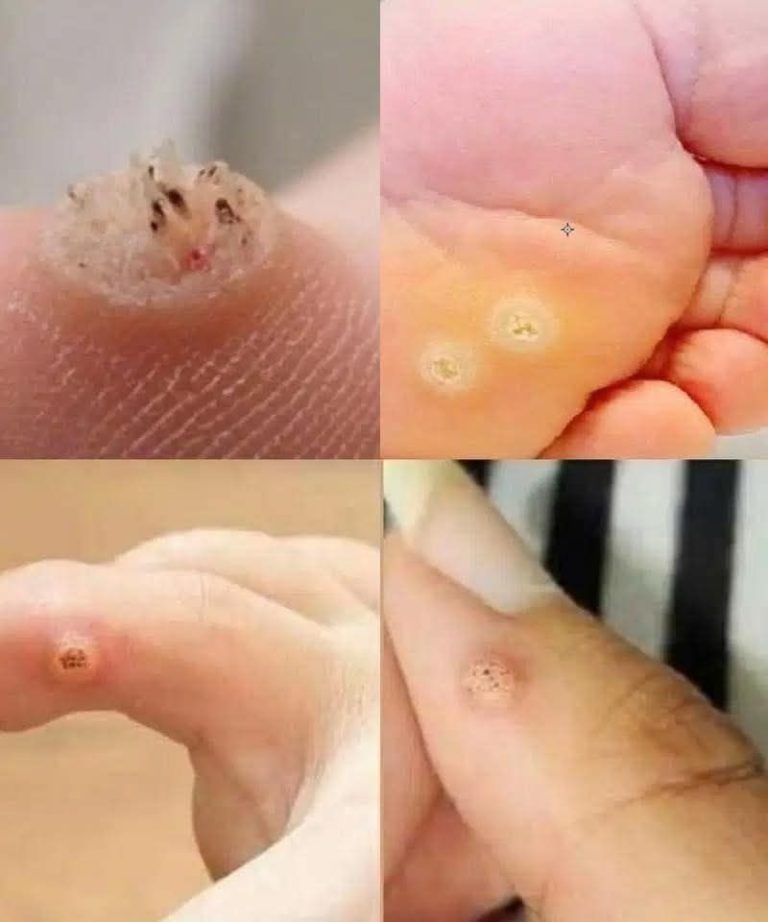 BE VERY CAREFUL . If you get this, you are i