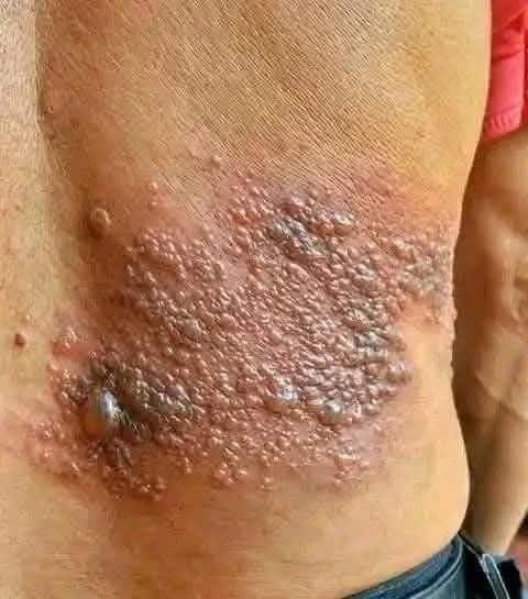 Young woman dies at the hands of her…See