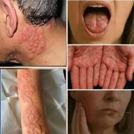 These are the signs that he is c