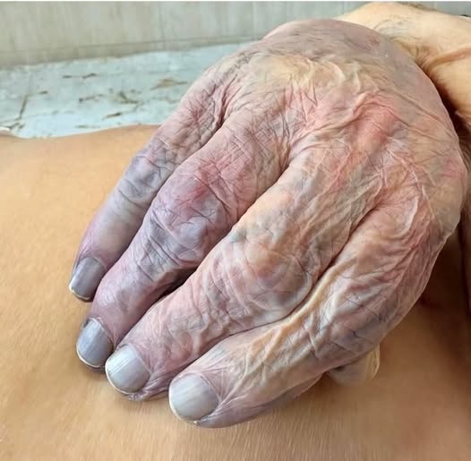 Signs on Your Hands That Could