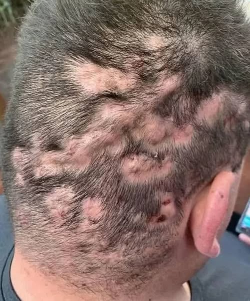 These are the first symptoms of sleepi