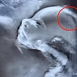 Doctors couldn’t believe what the