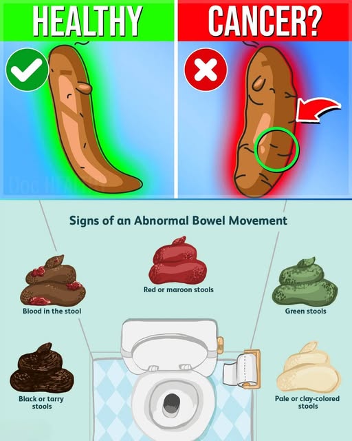 What Your Stool Color Reveals About Your