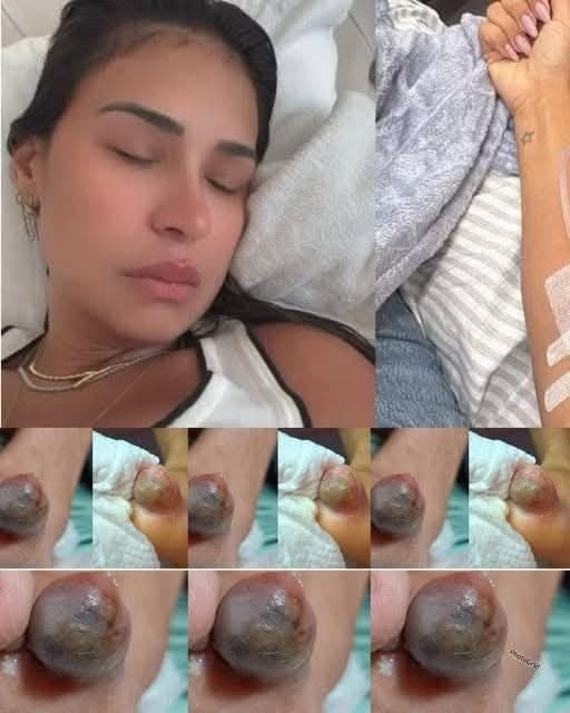 Be careful! These are the consequences of sle