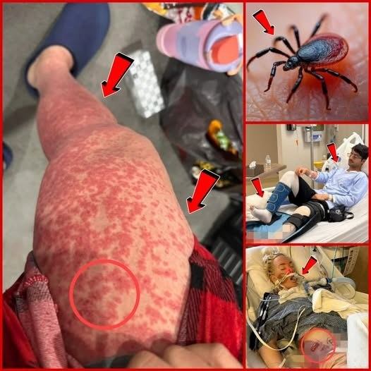 These are the consequences of s