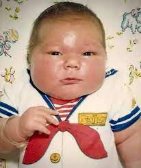 16-Pound Giant Baby Made Headlines In 1983