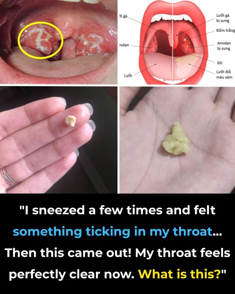 Here’s What You Need To Know Ab