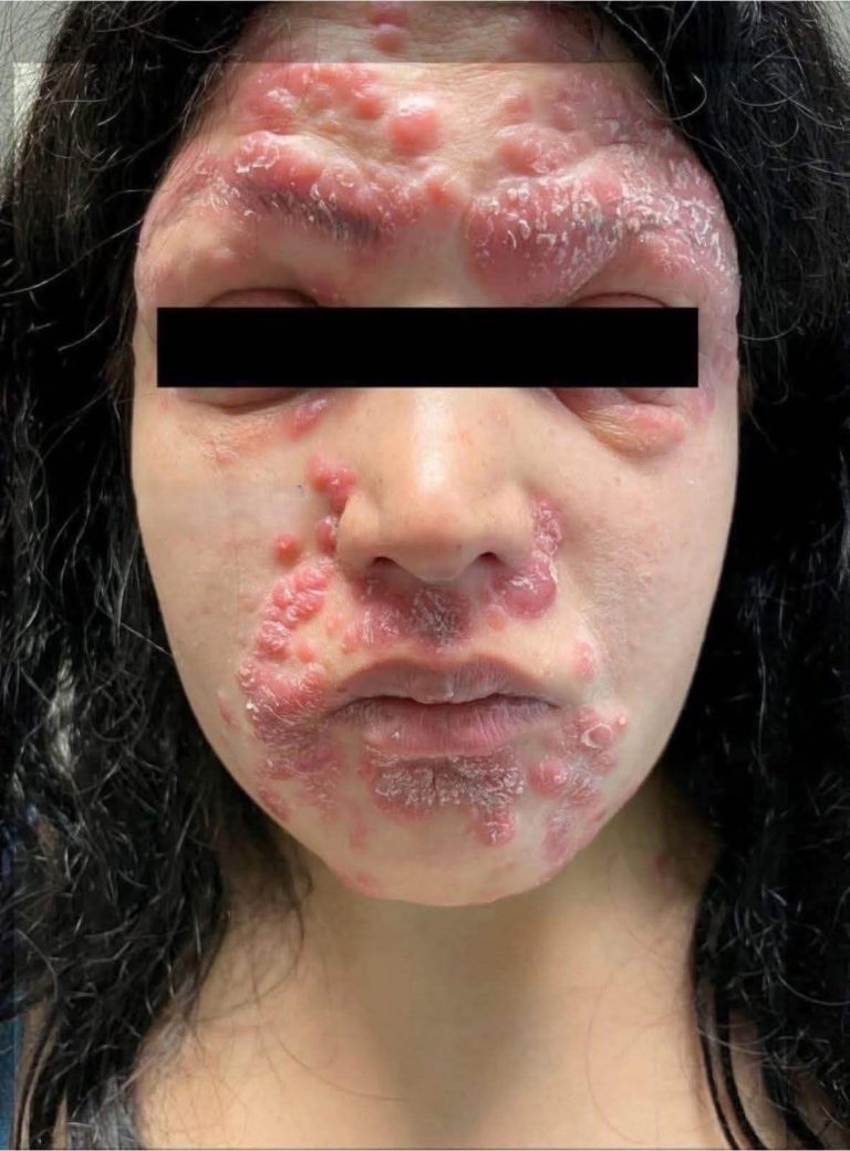 These are the consequences of