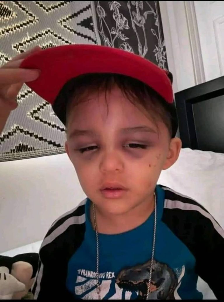 A 3-year-old boy was