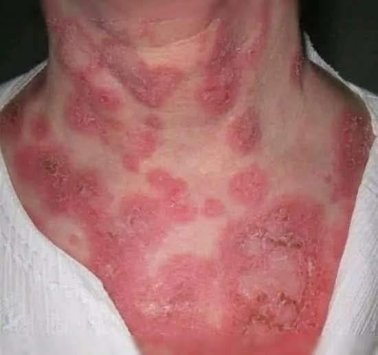 These are the consequences o