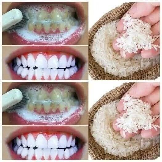 Teeth Whitening Trick wi