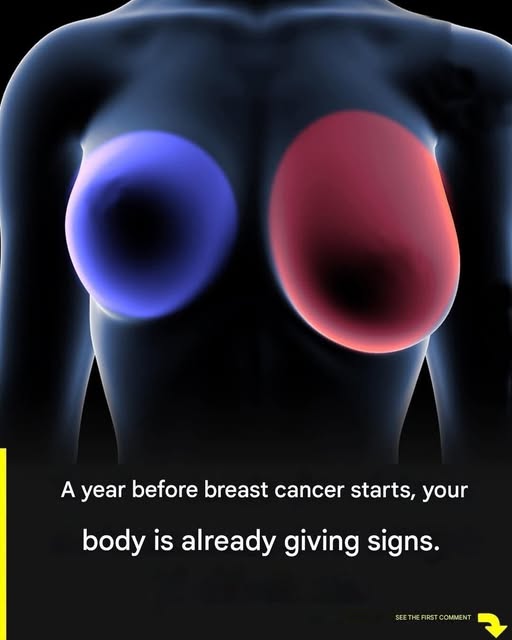 Breast Cancer Awareness: Four Early Wa