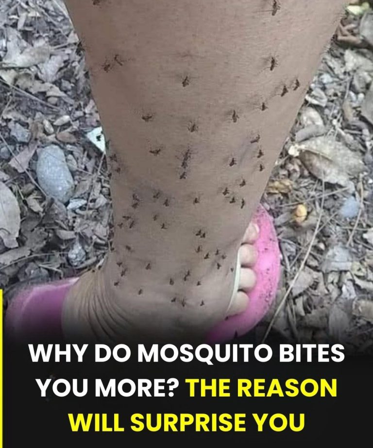 Why Mosquitoes Always Seem to