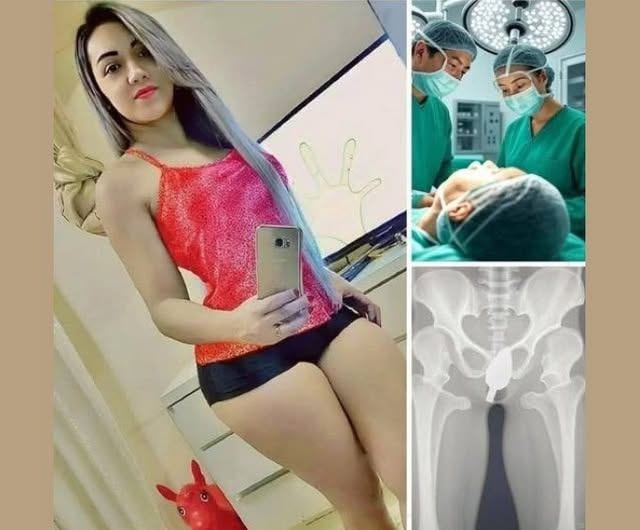 Girl was hospitalized for